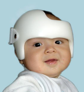 orthopädischer Helm, Kopforthese